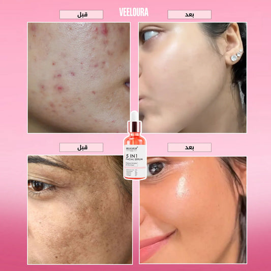سيروم 5 في 1 لتفتيح البشرة والتخلص من التجاعيد، التصبغات و البقع الداكنة