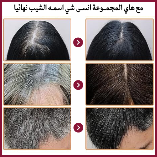 " SILVACARE™ المجموعة الرهيبة للتخلص من الشيب نهائيا